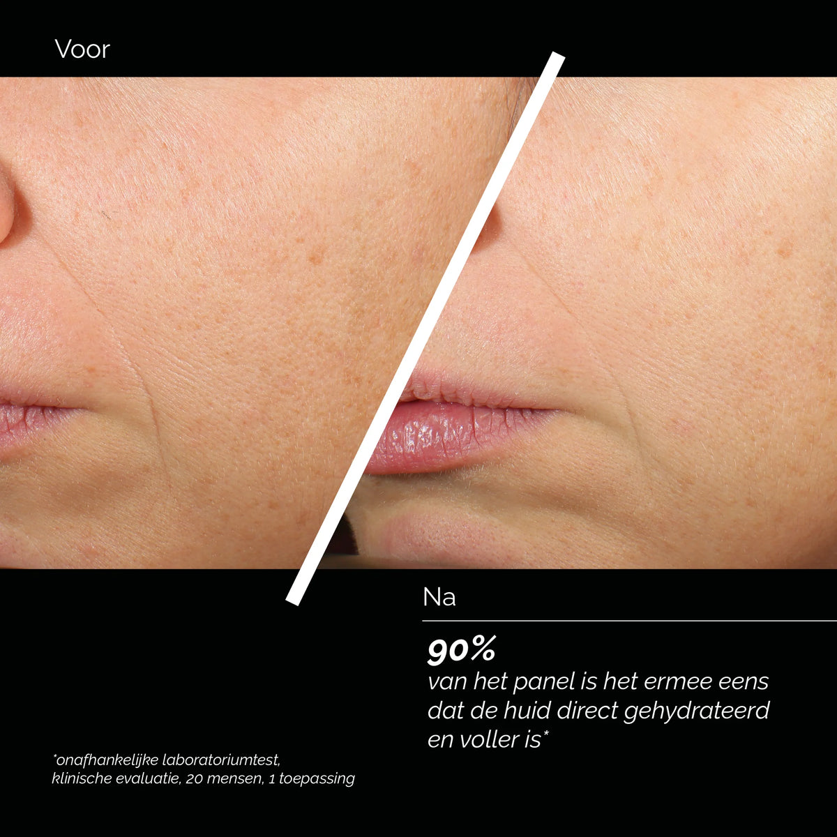Comfort Zone Skin Regimen Lx HA4 Jelly Serum antes y después