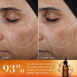 Super C Ferulic 30ml | Medik8